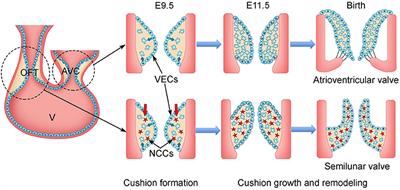 NOTCH Signaling in Aortic Valve Development and Calcific Aortic Valve Disease